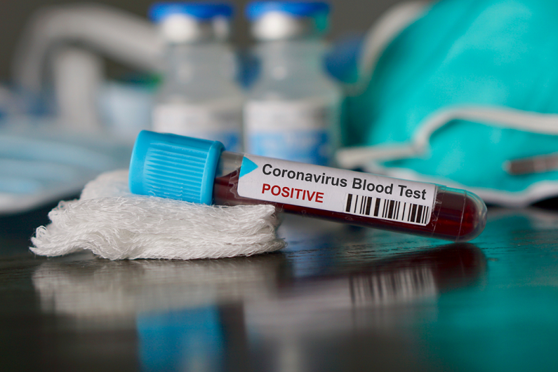 positive blood test result for coronavirus