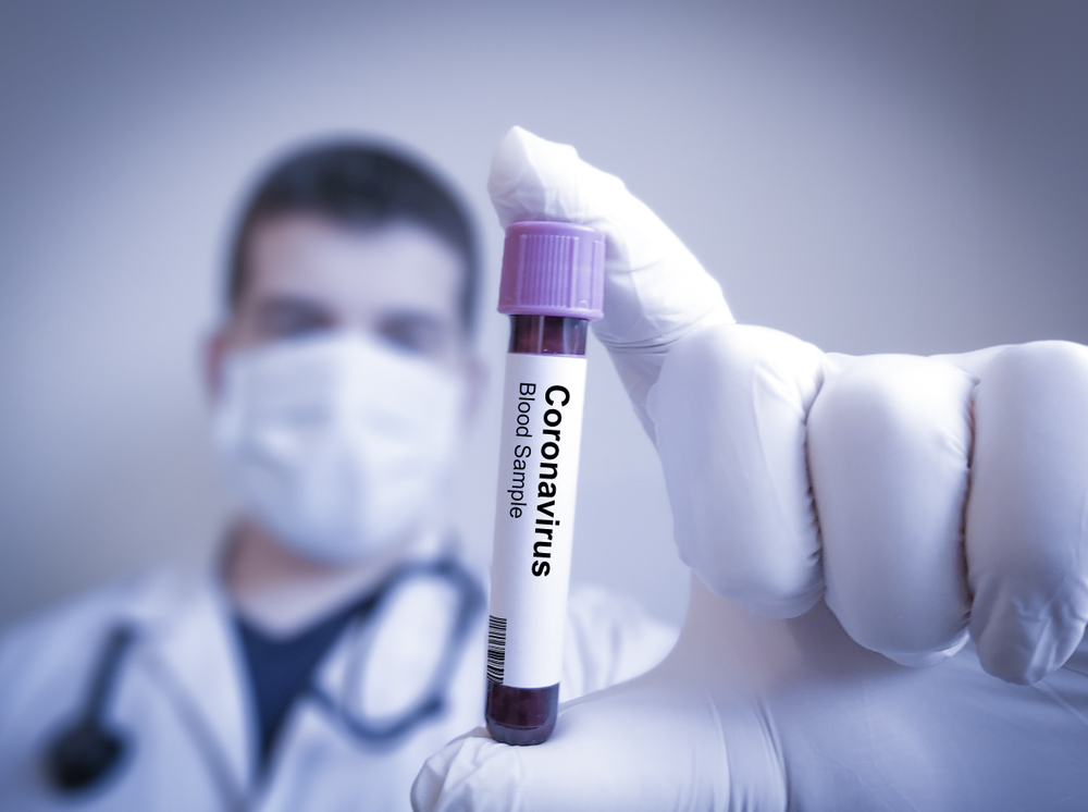 doctor holds blood sample for coronavirus testing