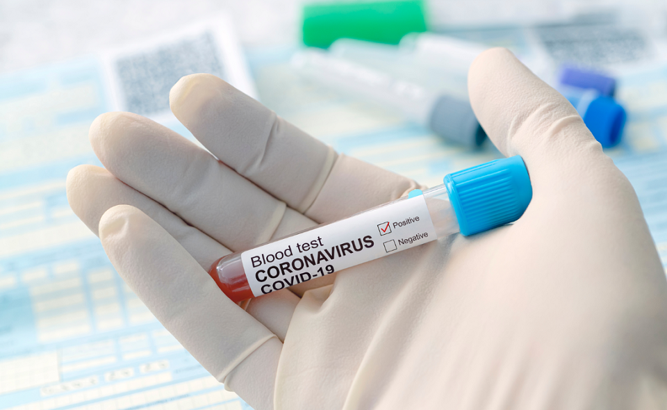 positive test for coronavirus