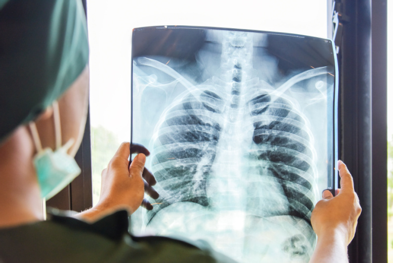 Doctor looks at chest x-ray