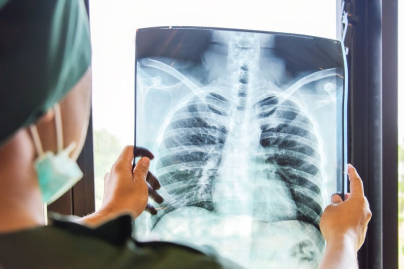 A doctor looks at a chest x-ray