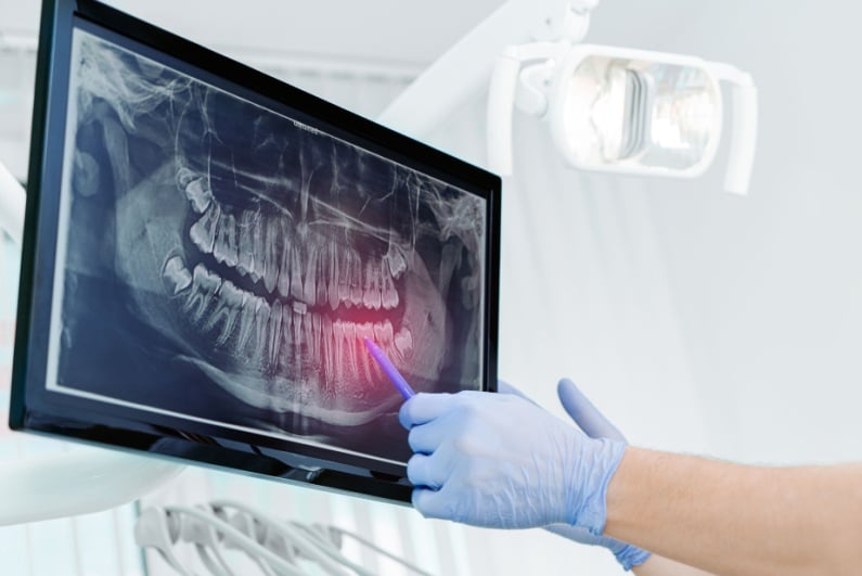 Dental x-rays